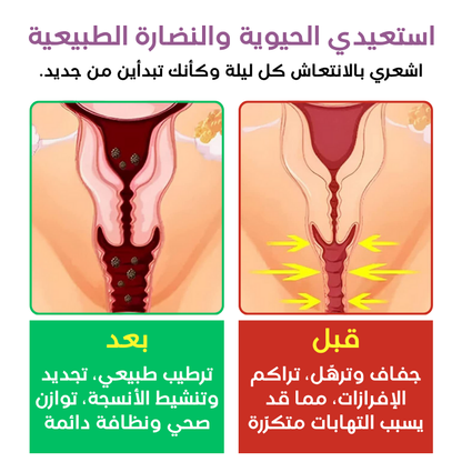 كبسولات تضييق المهبل