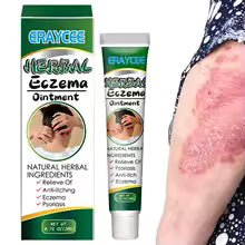 كريم الأعشاب لعلاج الإكزيما والصدفية