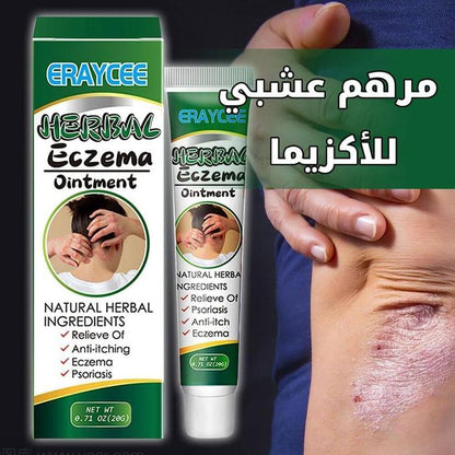 كريم الأعشاب لعلاج الإكزيما والصدفية