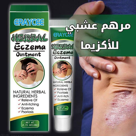 كريم الأعشاب لعلاج الإكزيما والصدفية